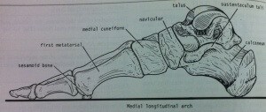 Diabetic Foot Ulcer